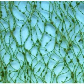   Silhouette 979-22 H Vörösfenyő lombanyag - téphető, Nyár (H0) kb. 50x31,5 cm